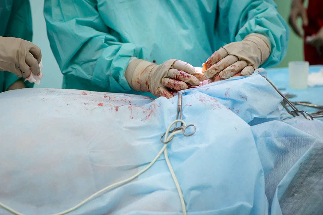 Suture Removal A Guide to Doing It Safely