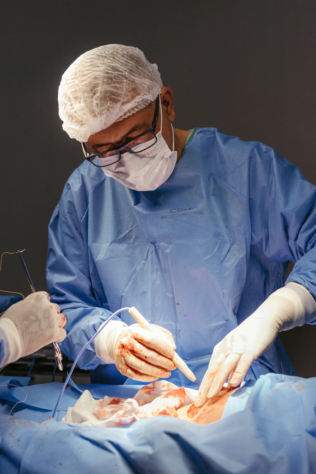 Discover the Latest Innovations in Surgical Sutures
