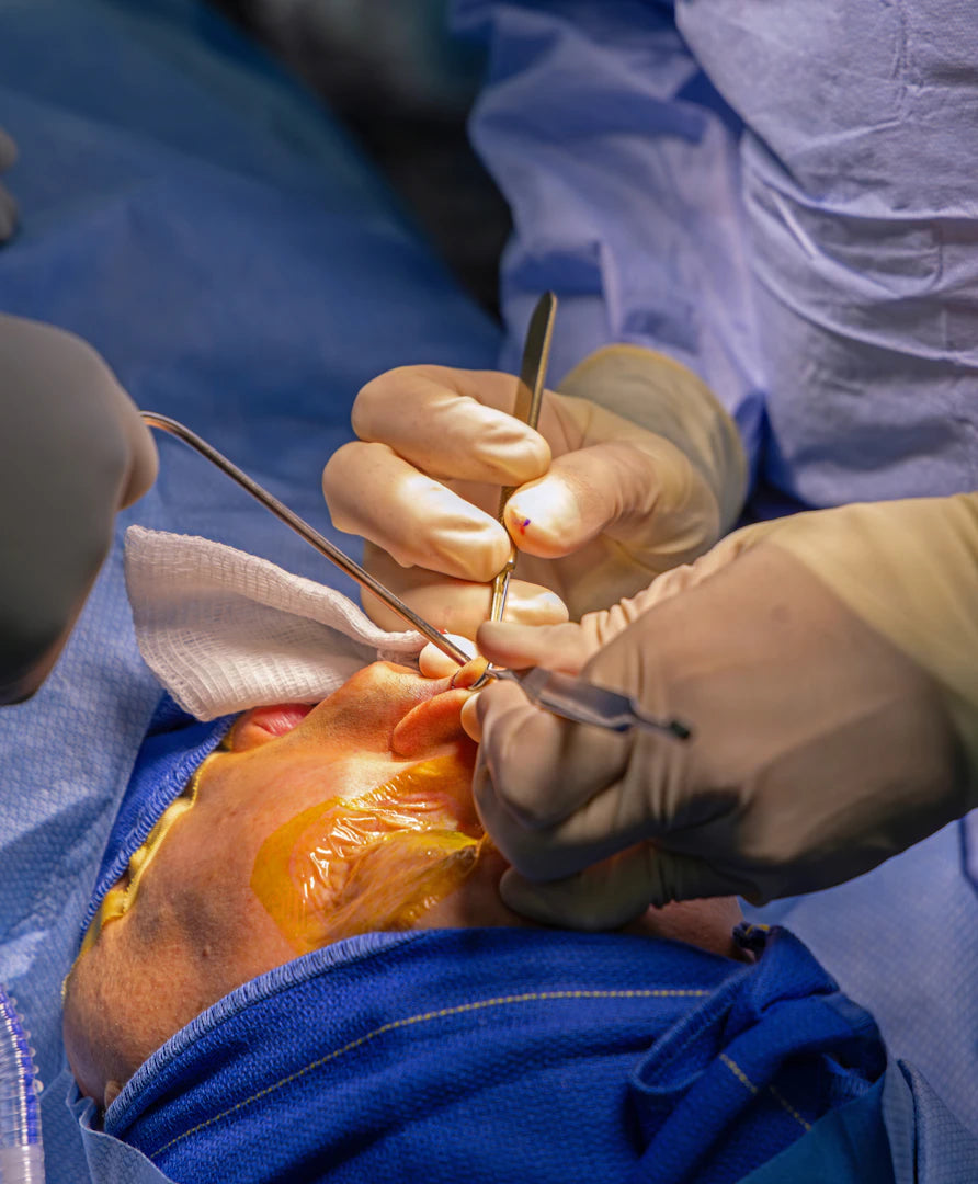 Mastering the World of Surgical Sutures
