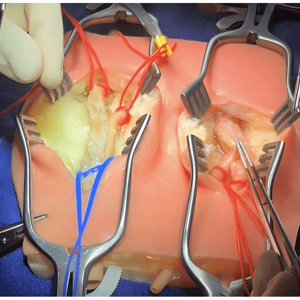 Embedded Carotid Arteries with Plaque and Dermis Model | Carotid Endarterectomy Training Simulator - Surgical TrainingLL-TRN-0244