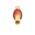 Ectopic Pregnancy Model | OB - GYN Surgical Training Simulator - Surgical TrainingLL-TRN-0507