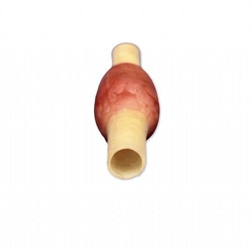 Ectopic Pregnancy Model | OB - GYN Surgical Training Simulator - Surgical TrainingLL-TRN-0507